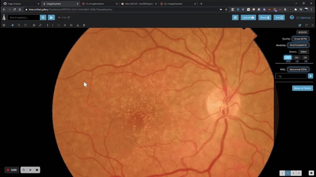 measure_ellipse.gif